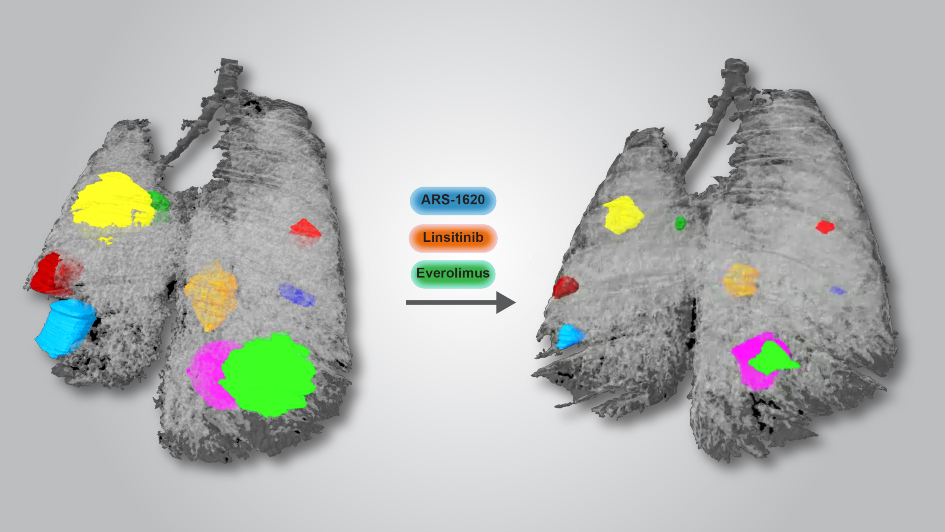 Lung cancer shrinkage in mouse tumours