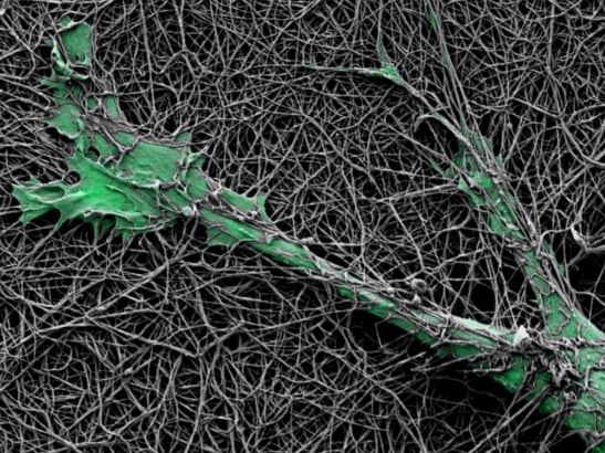 Microscope image of a green melanoma cell growing through mesh-like hydrogel matrix under.