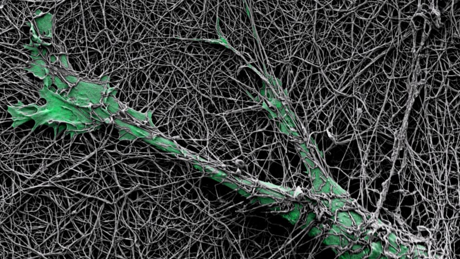 microscopic image of a green melanoma cell moving through mesh-like hydrogel