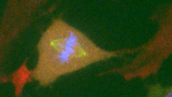 Normal diploid human Retinal Pigment Epithelial (RPE1) cell undergoing mitosis (image: Philippe Collin, Oxana Nashchekina and Mark Jackman)