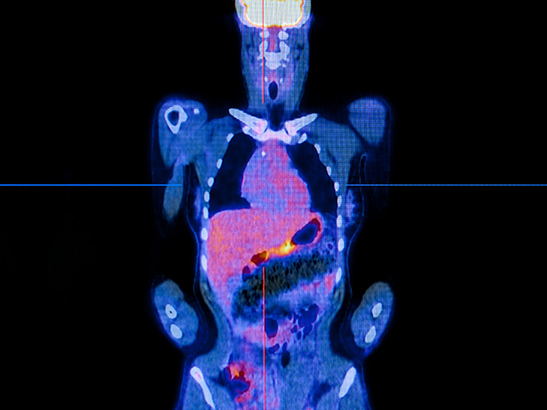 pet-scan content