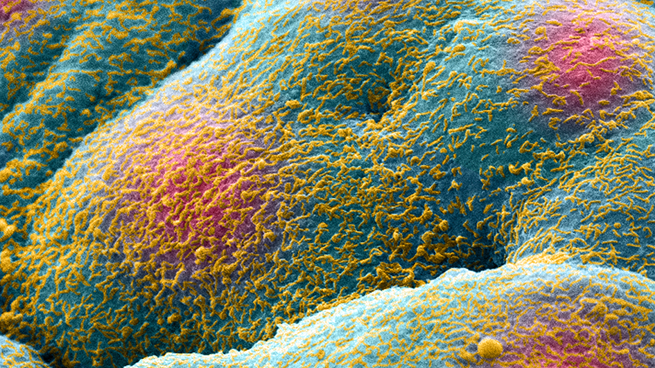 Prostate cancer cell spheroid 945x532px Prostate cancer cell spheroid 945x532px