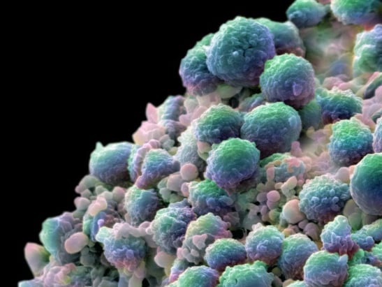 Prostate Cancer Cells 547x411px