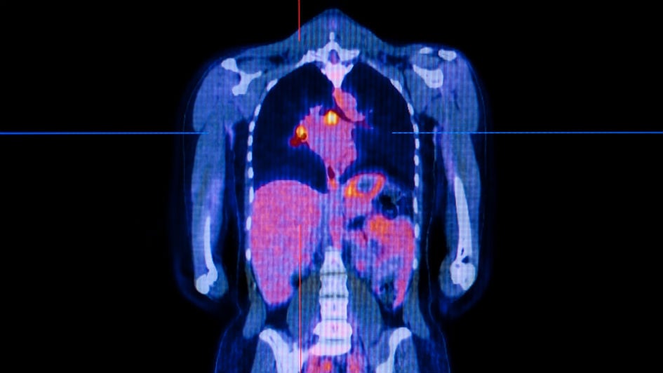 radiology carousel