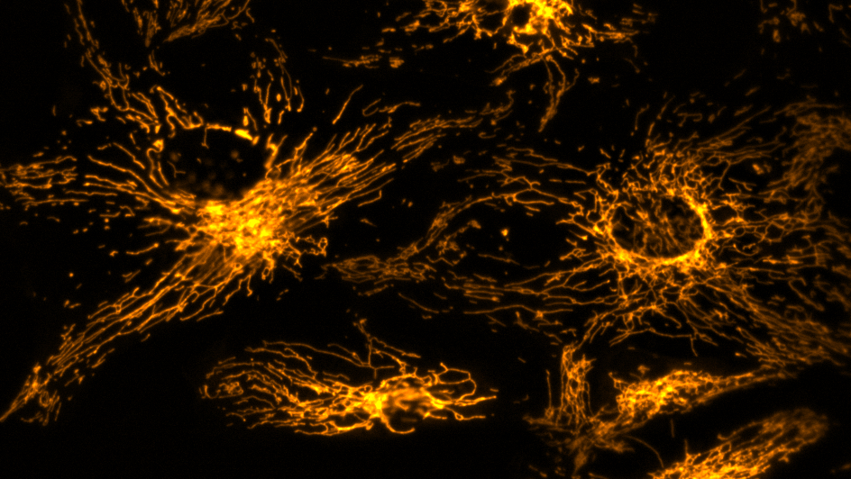 Image showing retina pigment epithelial cells that have been stained for reactive oxygen species