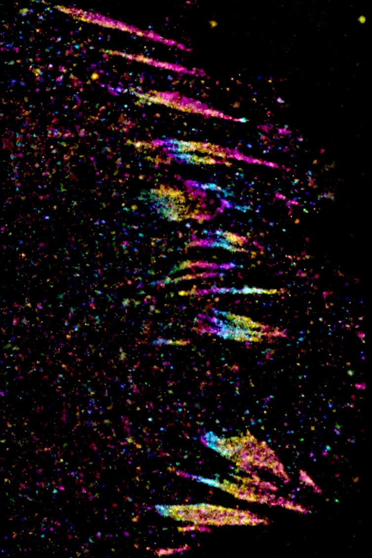 Super-resolution microscopy image of cell focal adhesions by PhD Student Ian Jones, Dr Lucas Dent, and Professor Chris Bakal