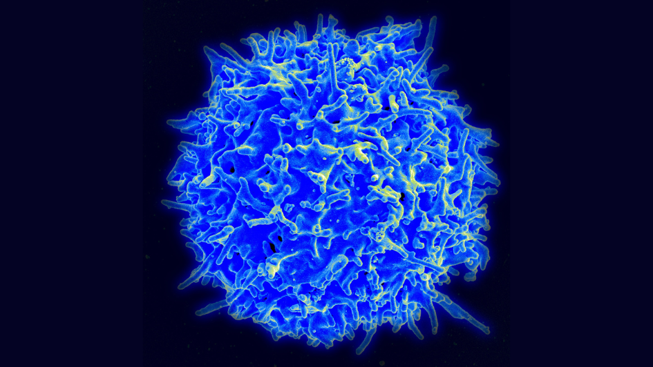 Human T cell. Credit: NIAID.