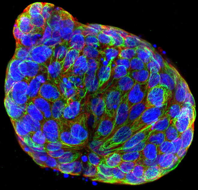 The Eye of the Storm - the tumultuous yet spectacular nature of cancer tumours by Dr Lisa Pickard and Louise Howell