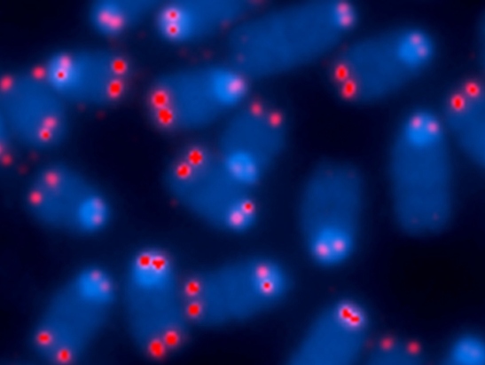 Microscope image of chromosomes with ends (telomeres) dyed red