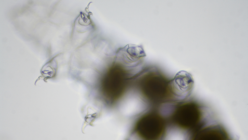 Underneath view of a tardigrade (or 'water bear')