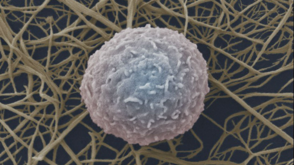 white blood cell carousel (photo: Wellcome Images)