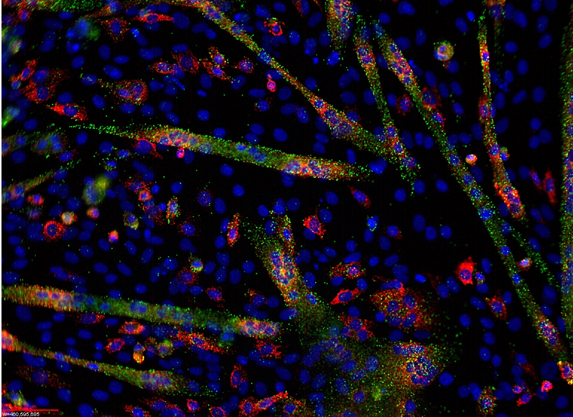 MicroRNA and mRNA in differentiating C1C12 cells