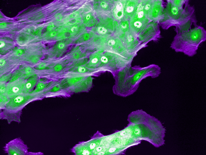 Cells responding to inflammation