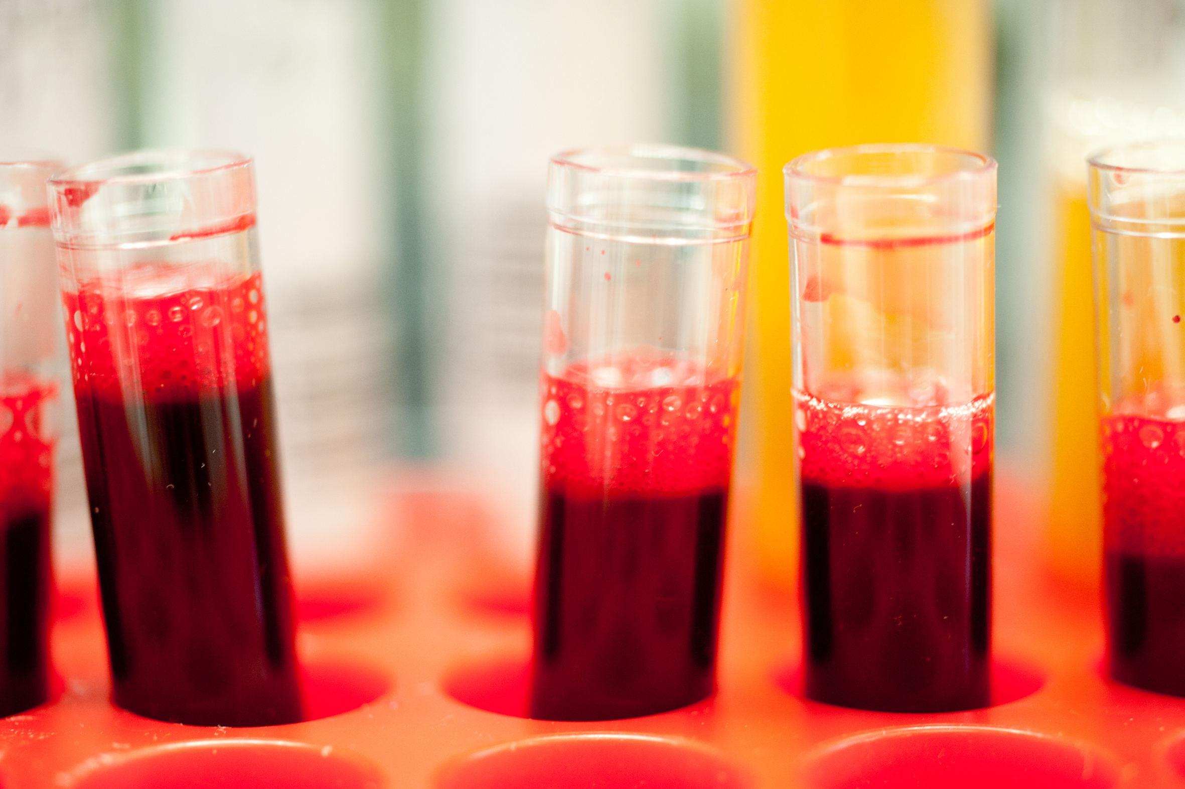 Blood samples (Jan Chlebik for the ICR, 2011)