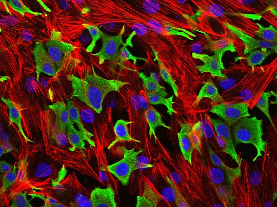 Breast cancer cells (green) invading through a layer of fibroblasts (red). (Luke Henry / the ICR, 2009)