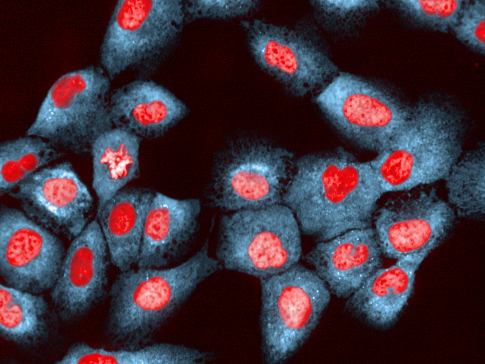 Breast epithelial cells under ER stress (Chris Bakal, 2014)