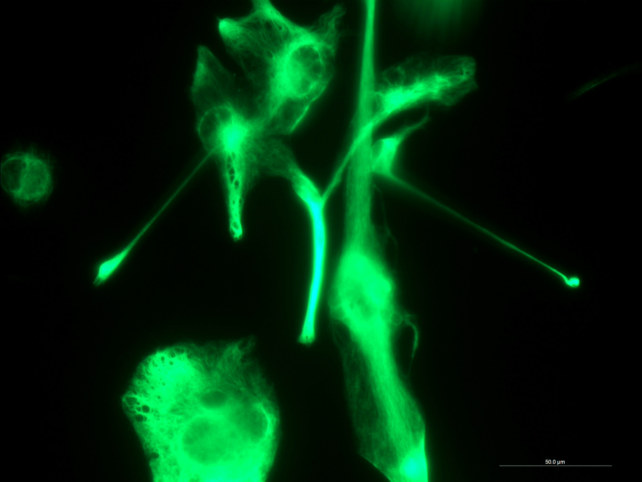 Glioblastoma cells