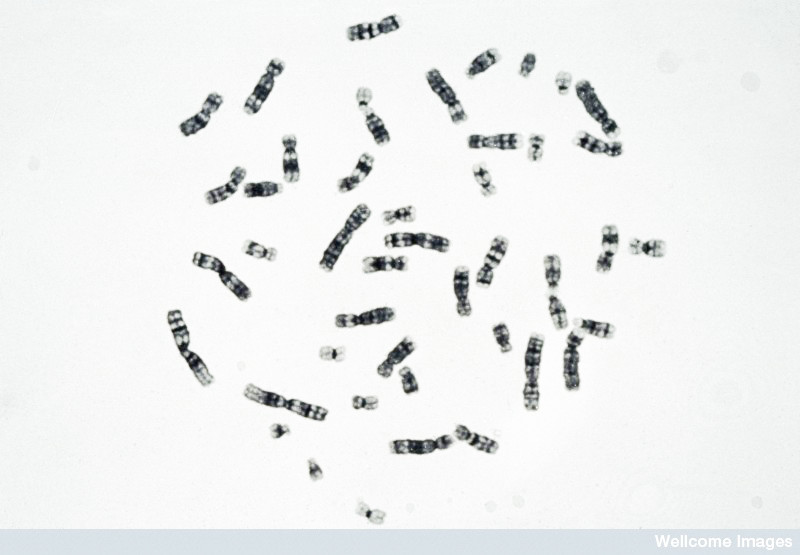 Normal human male metaphase, Y banding. Wessex Reg. Genetics Centre, Wellcome Images / Creative Commons by-nc-nd 2.0 UK